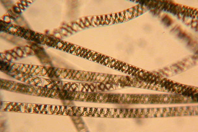 Spirogyra microscope view